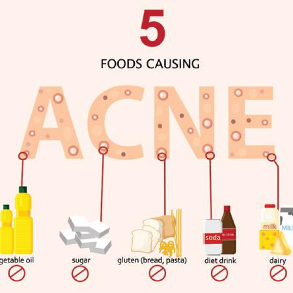 MỤN TRỨNG CÁ ĂN GÌ VÀ TRÁNH GÌ ?