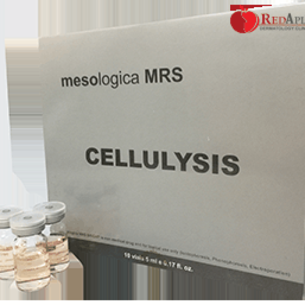 PHƯƠNG PHÁP ĐÁNH TAN MỠ( CELLULYSIS )